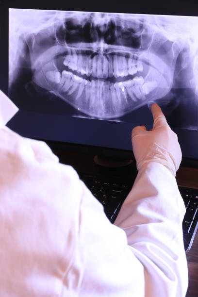 Best Emergency Broken Tooth Repair in Marcus, IA
